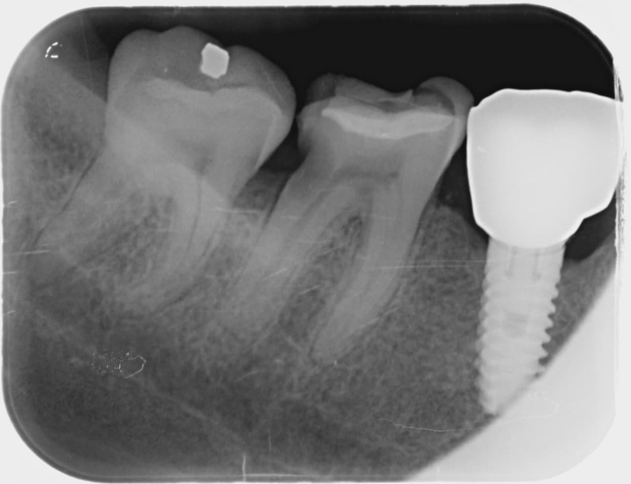 Imagenología y Radiología Digital